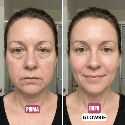 LunaSculpt – Spazzola per il drenaggio linfatico del viso